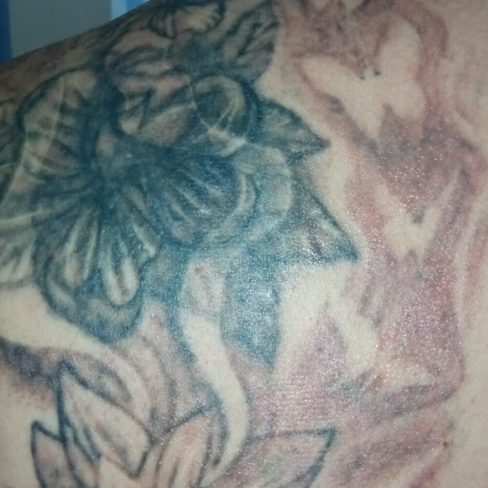 Tatuaje floral en la espalda: Tras 1 sesión