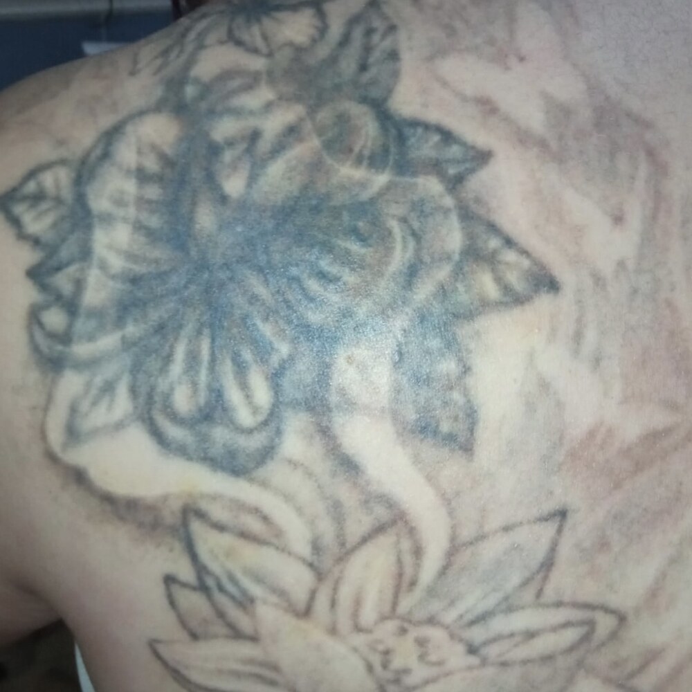 Tatuaje floral en la espalda: Tras 2 sesiones